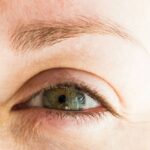 Enfermedades que causan la caída de pestañas y cejas: ¿Por qué sucede?