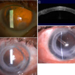 Poder del Hidrogel de Brill Pharma