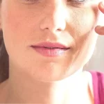Tratamiento natural para queratosis seborreica: remedios sin fármacos