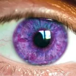 Síndrome de Alejandría: desmintiendo el mito de los ojos violeta